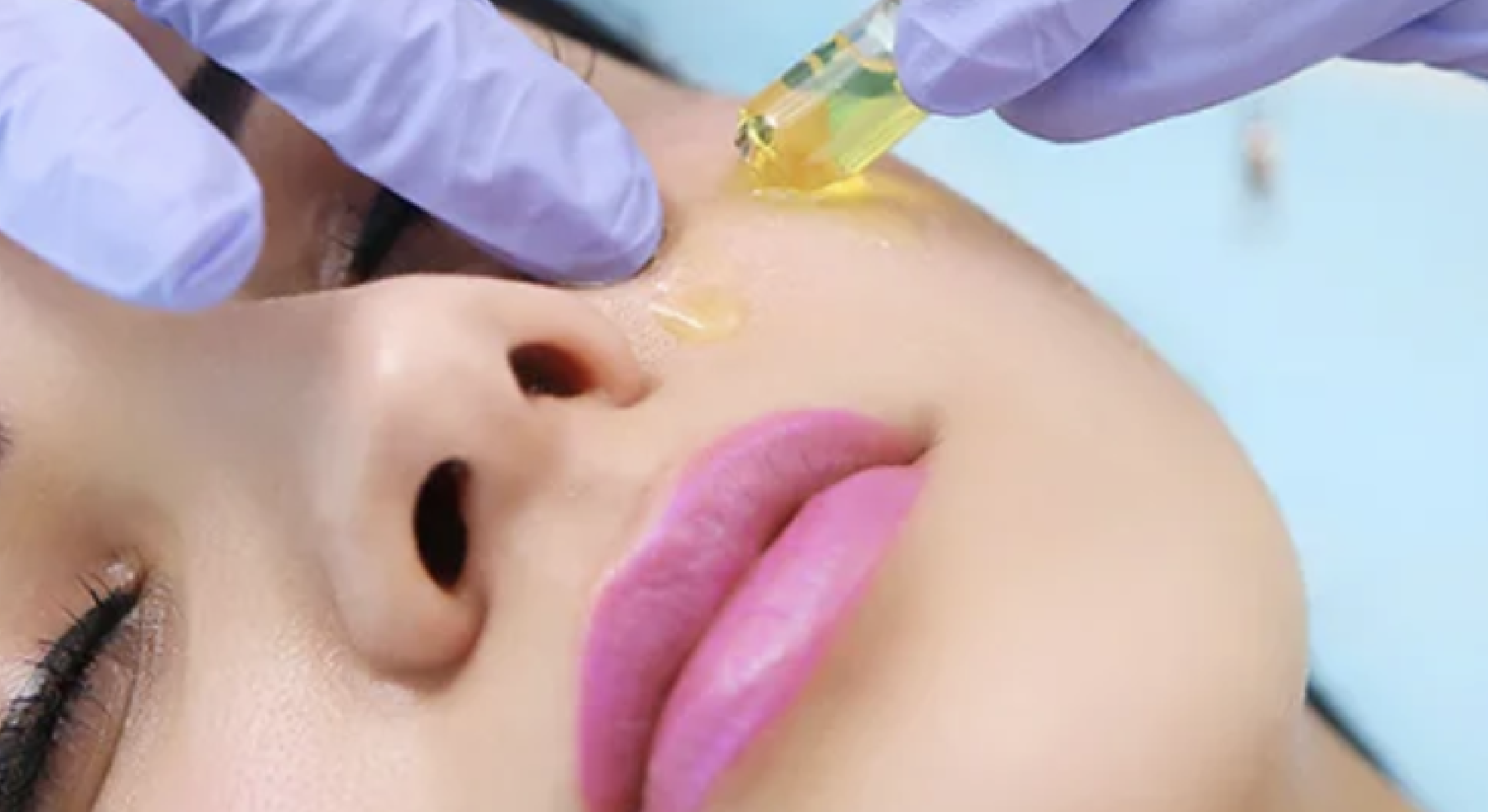 Mesoterapia