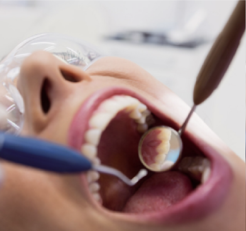 Periodoncia